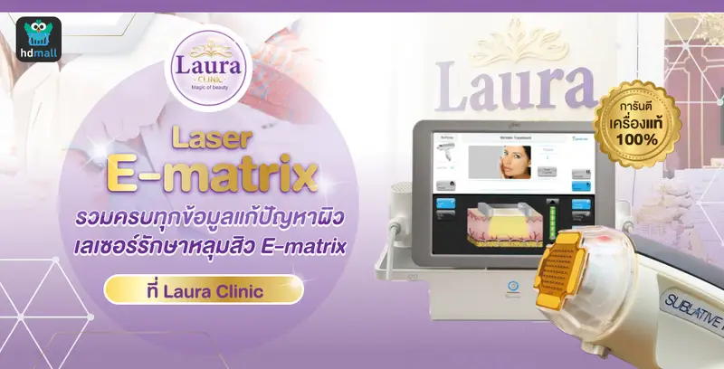 รักษาหลุมสิวด้วยเครื่อง E-matrix ที่ Laura Clinic