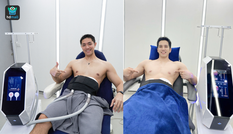 ขั้นตอนการทำ M Abs : Tesla Sculpt