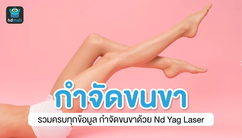 เลเซอร์กำจัดขนขา รวมครบทุกข้อมูลกำจัดขนขาด้วย Nd:YAG Laser
