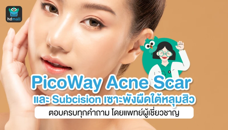 PicoWay Acne Scar และ Subcision เซาะพังผืดใต้หลุมสิว ตอบครบทุกคำถามโดยแพทย์ผู้เชี่ยวชาญ