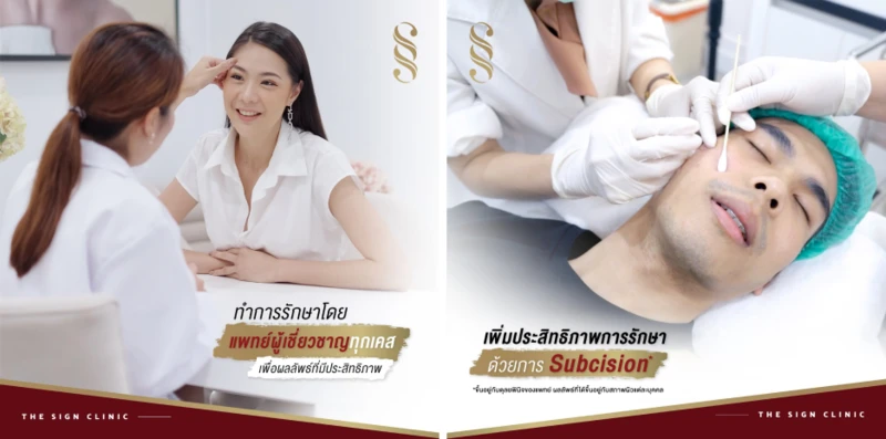 content hdinsight program picoway acne scar at the sign clinic2
