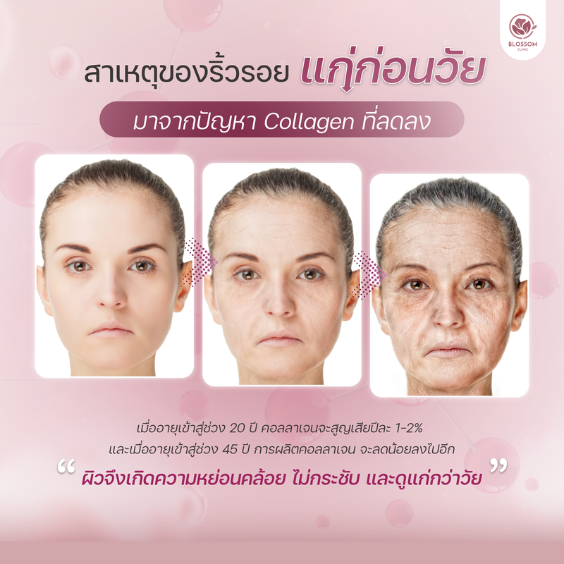 สาเหตุของริ้วรอยแก่ก่อนวัย