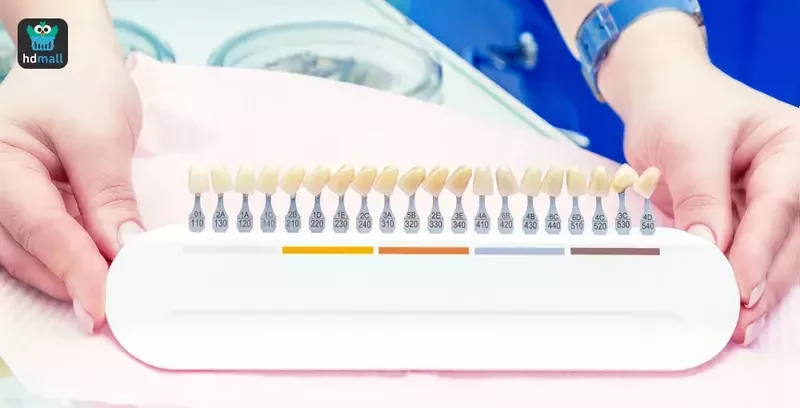 แถบวัดสีฟันมาเปรียบเทียบกับฟันของผู้รับบริการฟอกสีฟัน