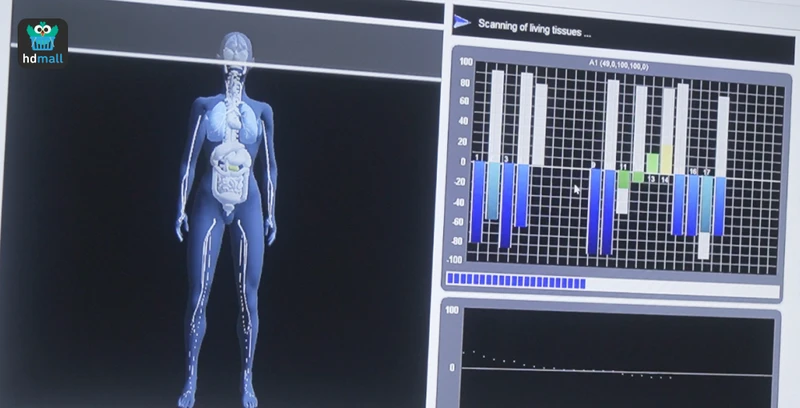 ขั้นตอนการตรวจ Bio Body Scan