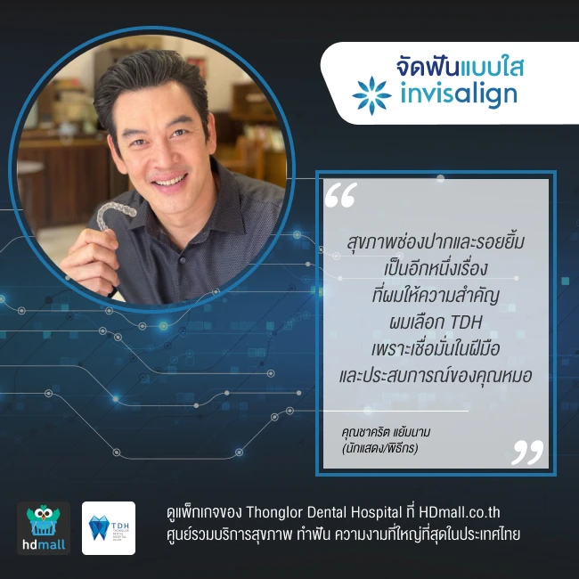 content review before after invisalign tdh8