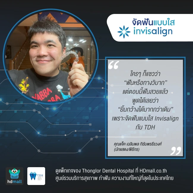 content review before after invisalign tdh9