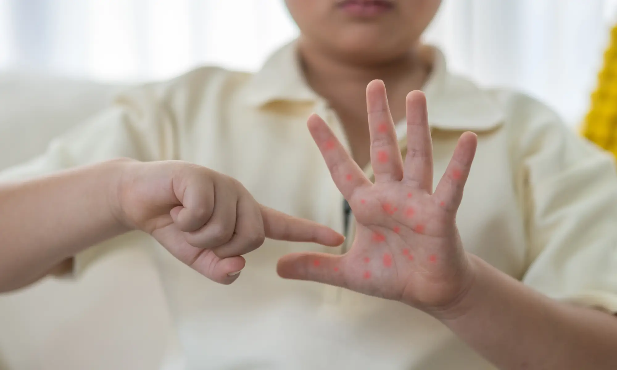how hand foot mouth disease spreads disease definition