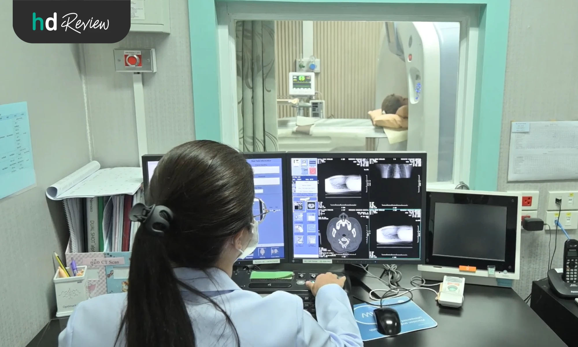 ผลตรวจ CT Scan หัวใจ