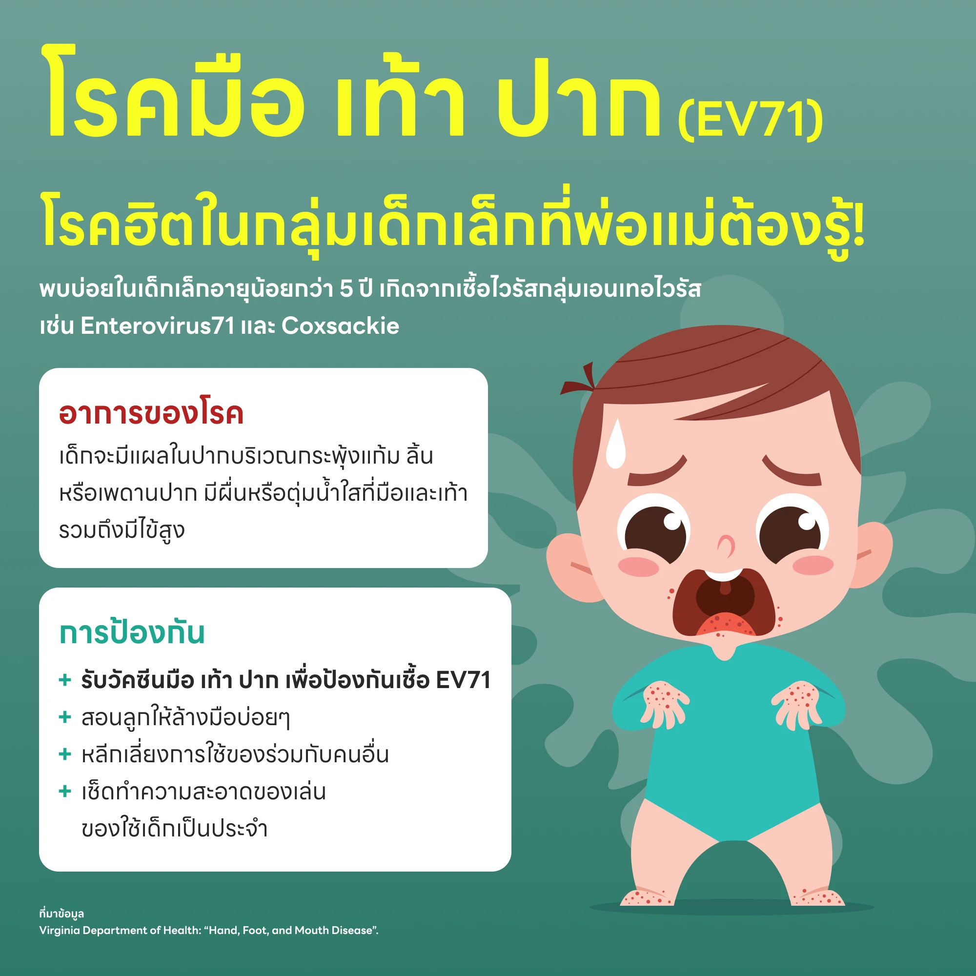โรคมือ เท้า ปาก