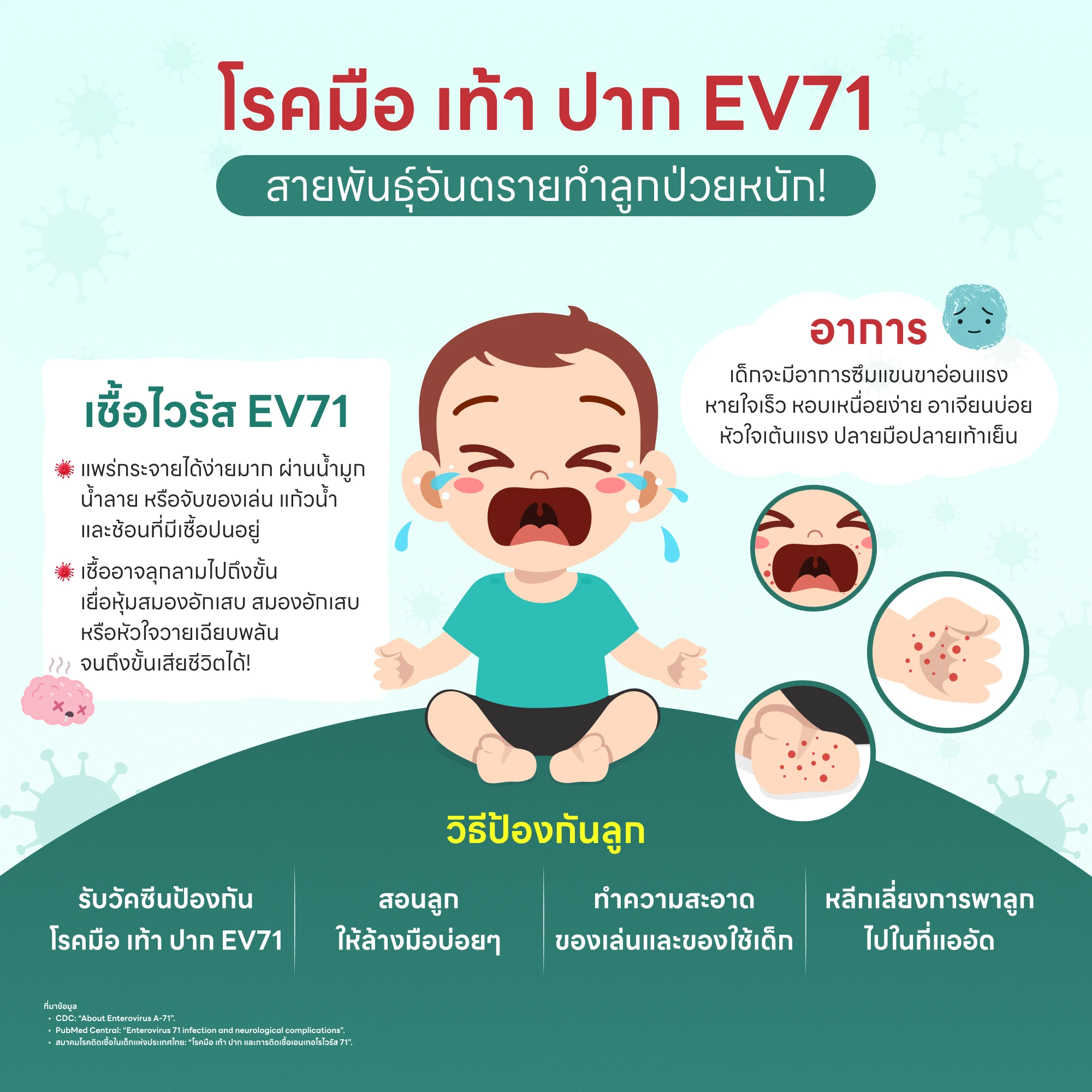 โรคมือ เท้า ปาก EV71