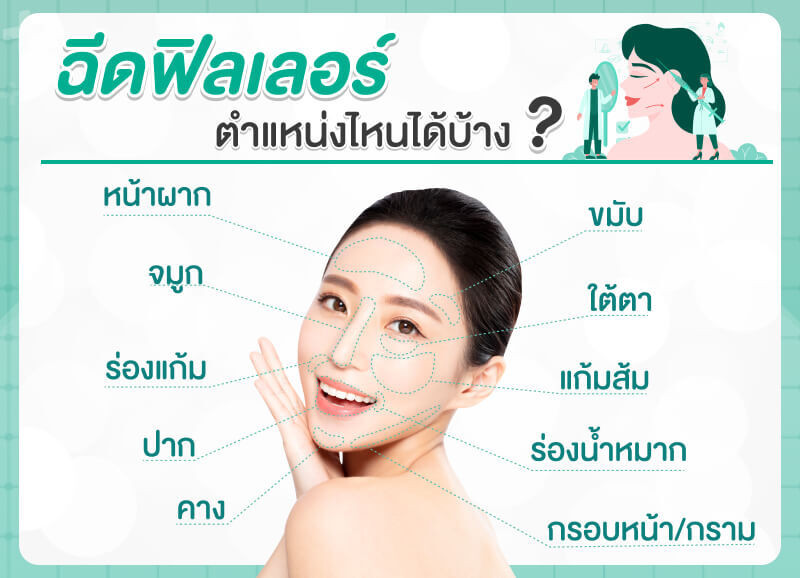 ตำแหน่งที่ฉีดฟิลเลอร์ได้