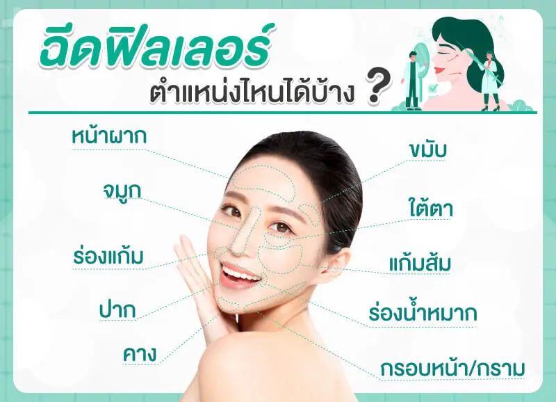 ตำแหน่งที่ฉีดฟิลเลอร์ได้