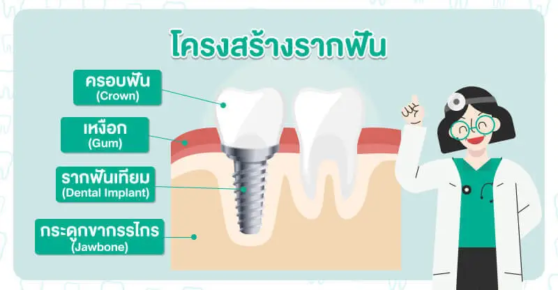 โครงสร้างของรากฟันเทียม