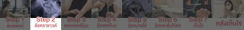 รีวิว ฝากไข่ 7 ขั้นตอน โดยละเอียด ที่ โรงพยาบาลพญาไท 2