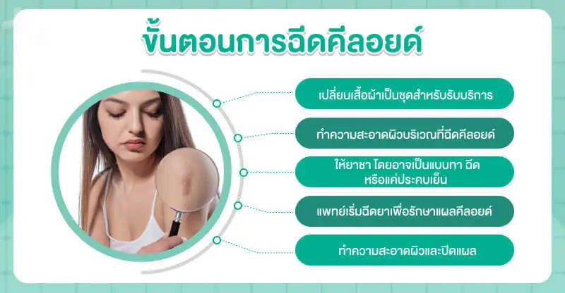 ขั้นตอนการฉีดคีลอยด์