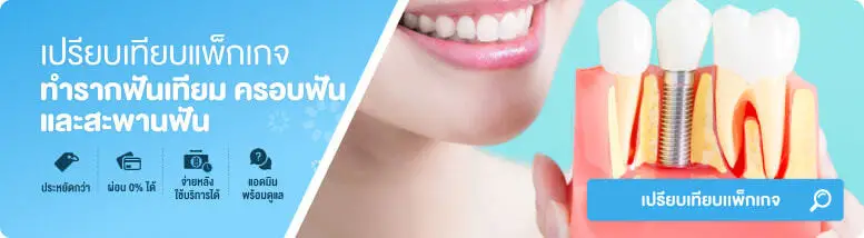 สะพานฟันราคา