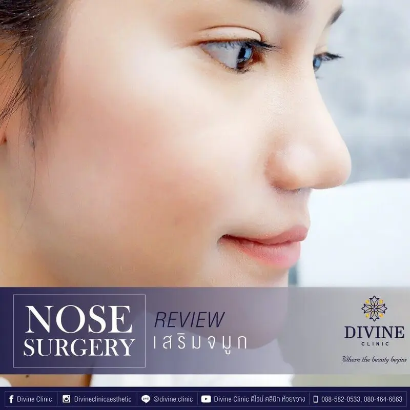 รีวิวเสริมจมูกจากคลินิก