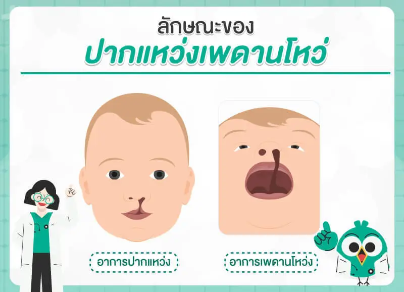 ความแตกต่างระหว่างปากแหว่งและเพดานโหว่