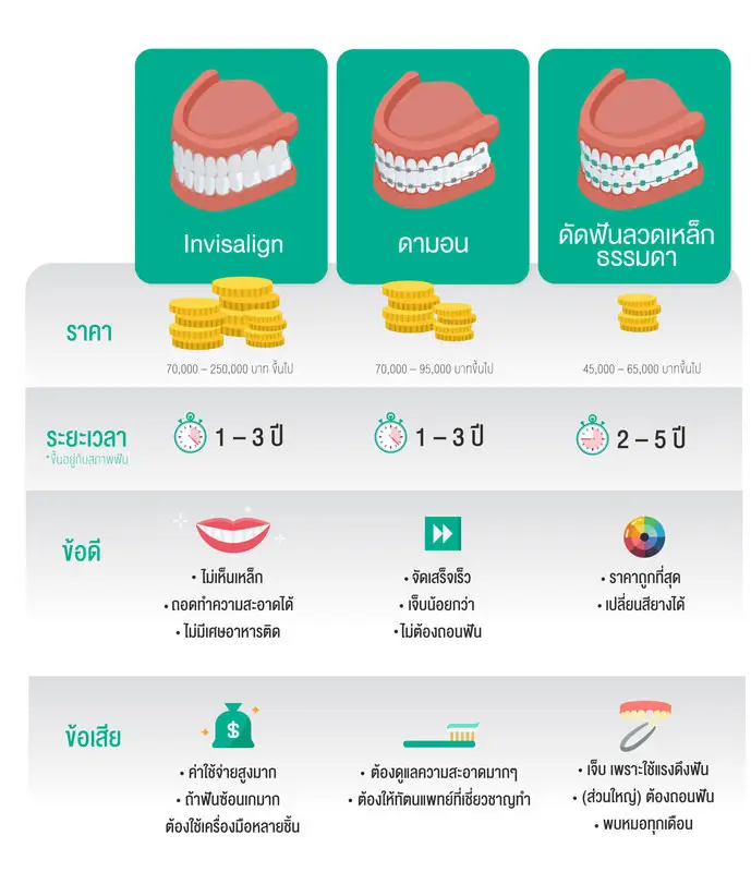 เปรียบเทียบการจัดฟัน เปรียบเทียบการจัดฟัน