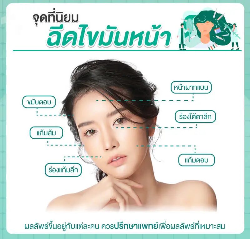 ฉีดไขมันหน้า ลดอายุผิว ฟื้นฟูหน้าเด็กถาวร 1 ตำแหน่งที่นิยมฉีดไขมันหน้า