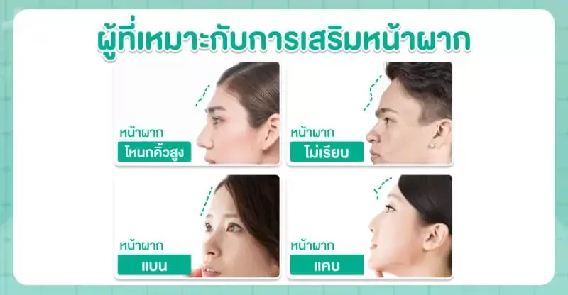 ผู้ที่เหมาะกับการเสริมหน้าผาก