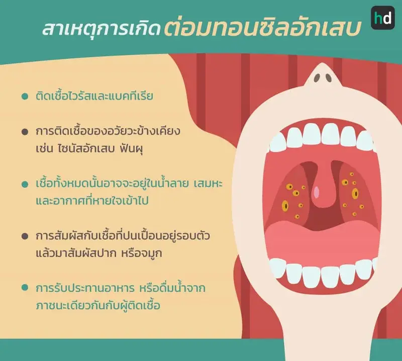 สาเหตุการเกิด ต่อมทอนซิลอักเสบ