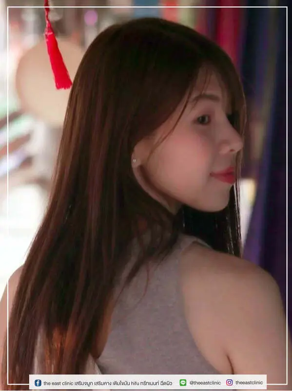 รีวิวเสริมจมูกจากคลินิก