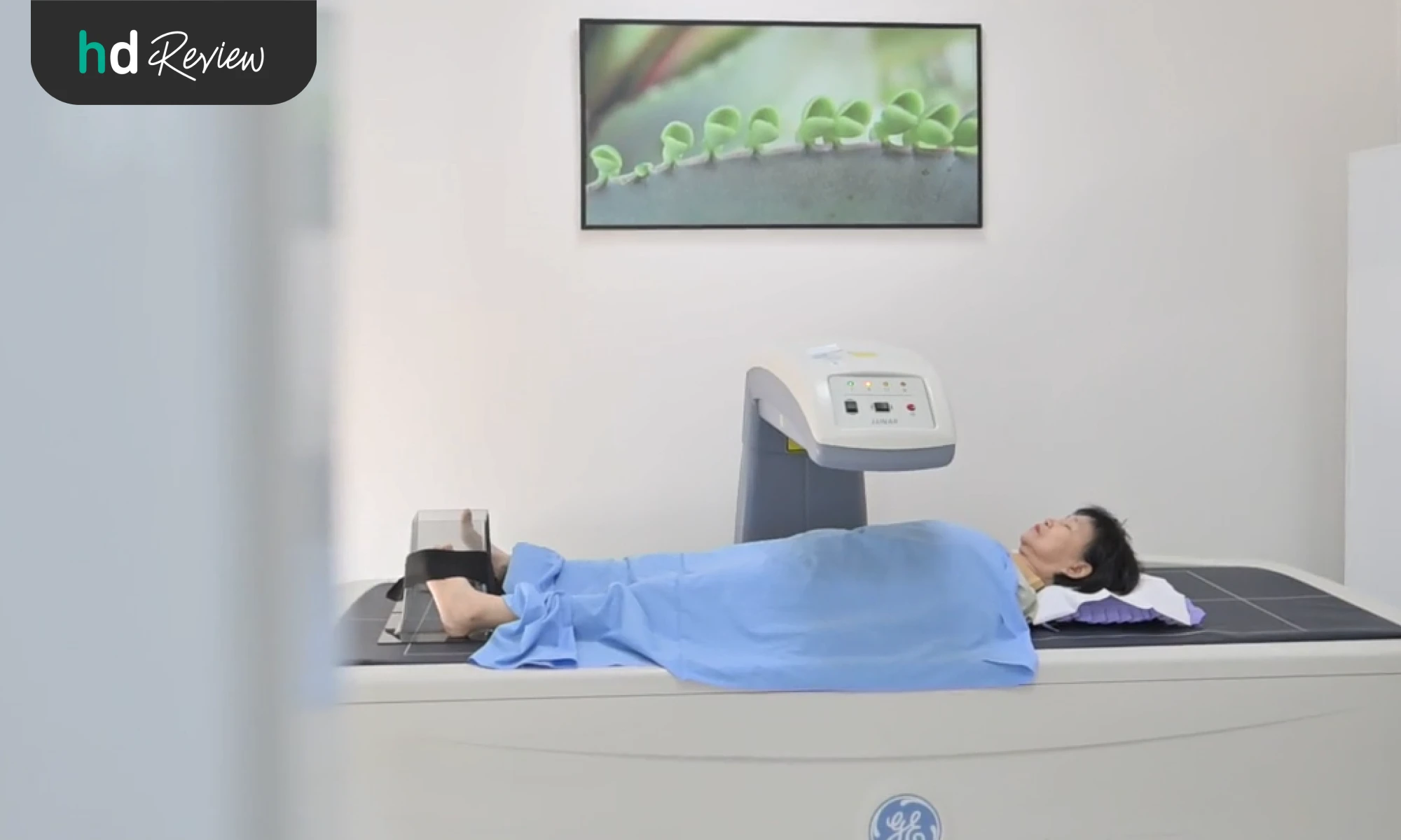 ให้เครื่องตรวจสแกนมวลกระดูกอัตโนมัติ