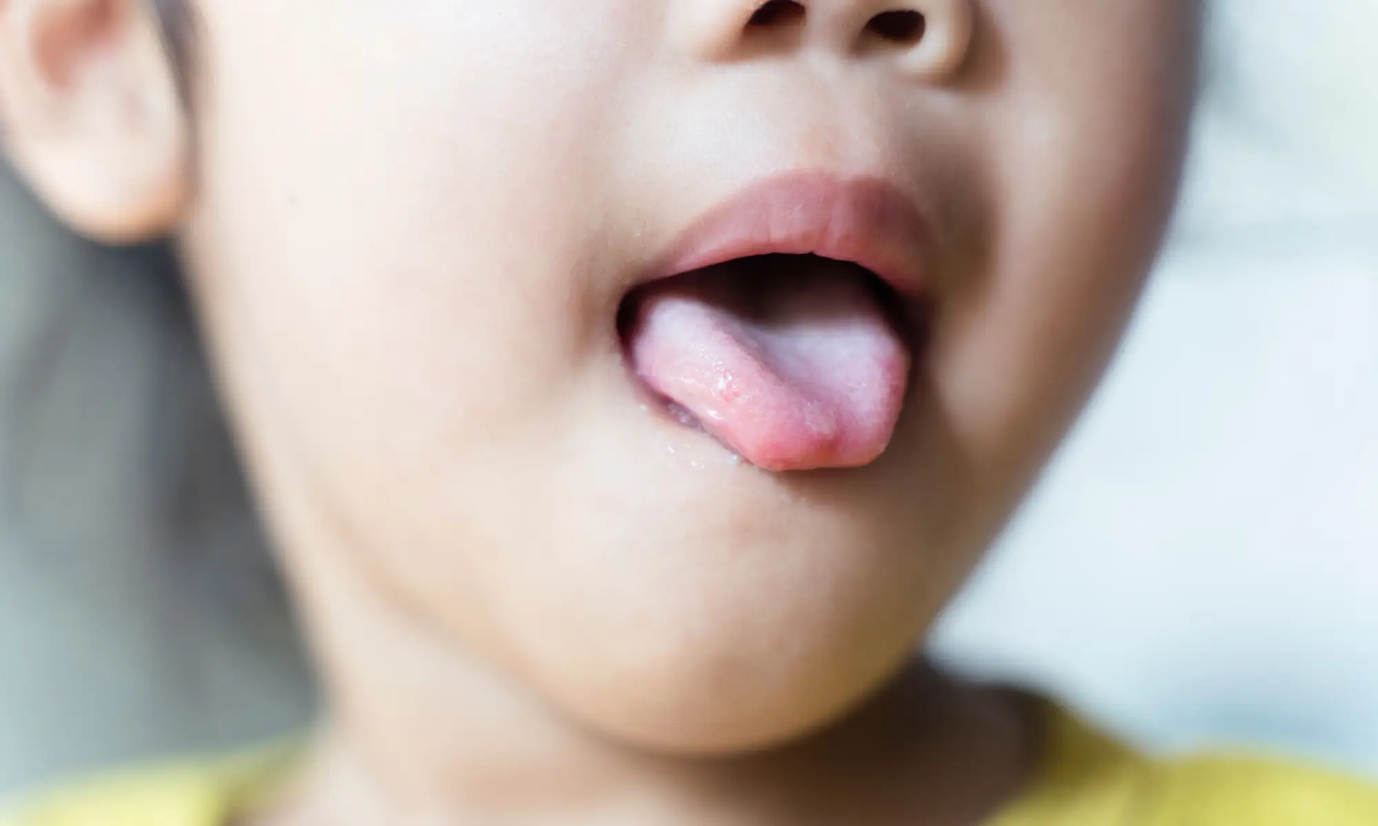 what parents need to know about hfmd disease faq