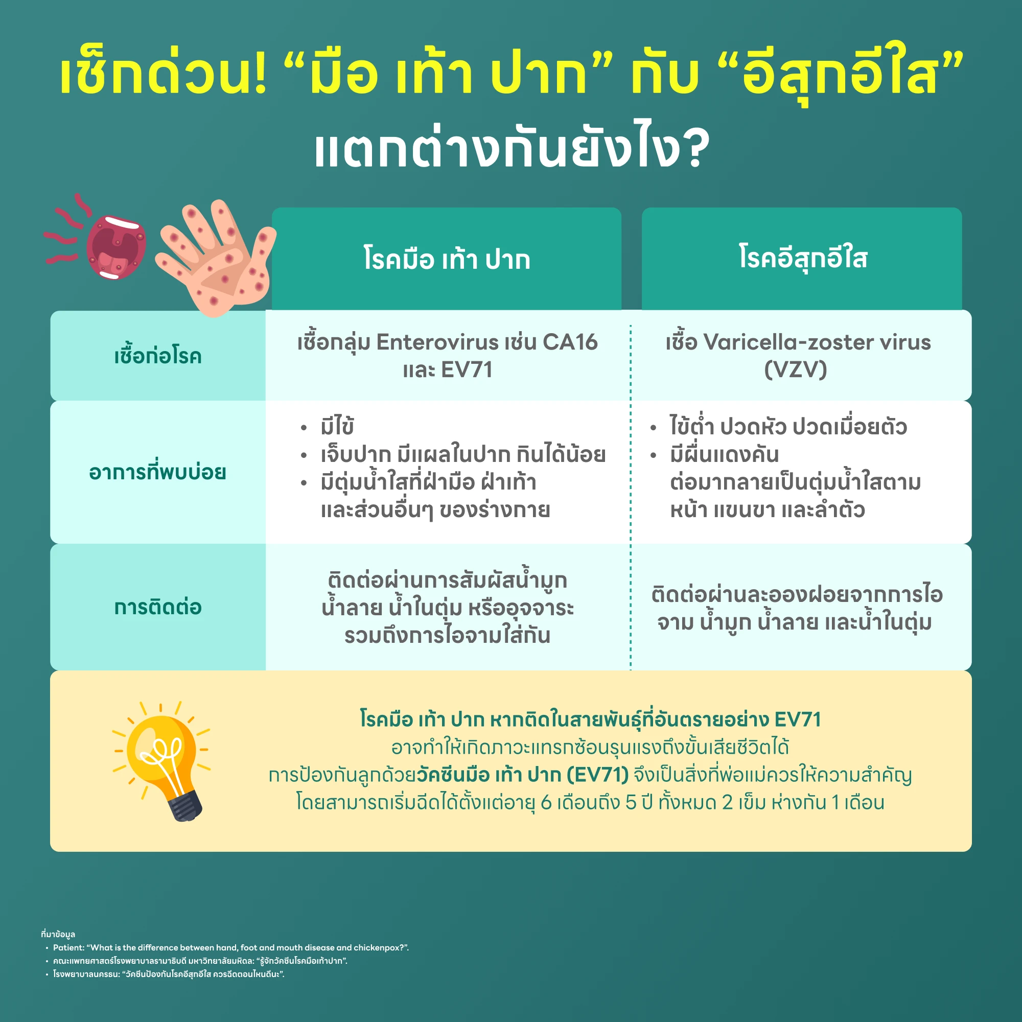 มือ เท้า ปาก กับ อีสุกอีใส แตกต่างกันยังไง