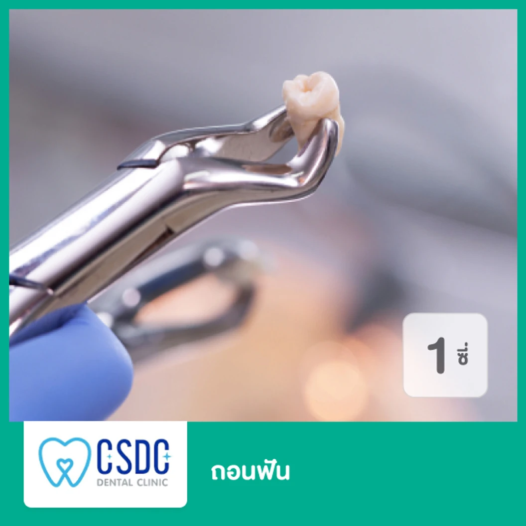 ถอนฟัน 1 ซี่ เฉพาะสาขา ม.เกษตรเท่านั้น ที่ CSDC