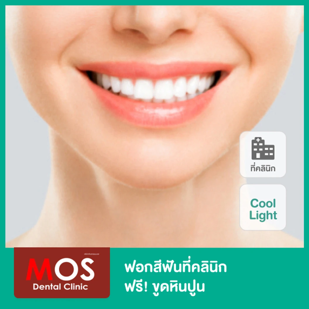 ฟอกสีฟันที่คลินิกด้วยระบบ Cool Light พร้อมขูดหินปูน ที่ MOS Dental Clinic