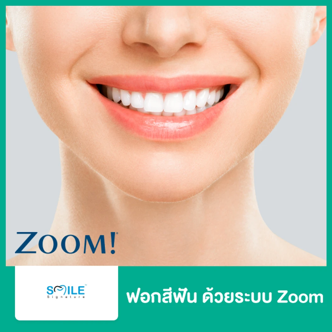 ฟอกสีฟัน ด้วยระบบ Zoom ที่ Smile Signature คลินิกทันตกรรมสไมล์ ซิกเนเจอร์