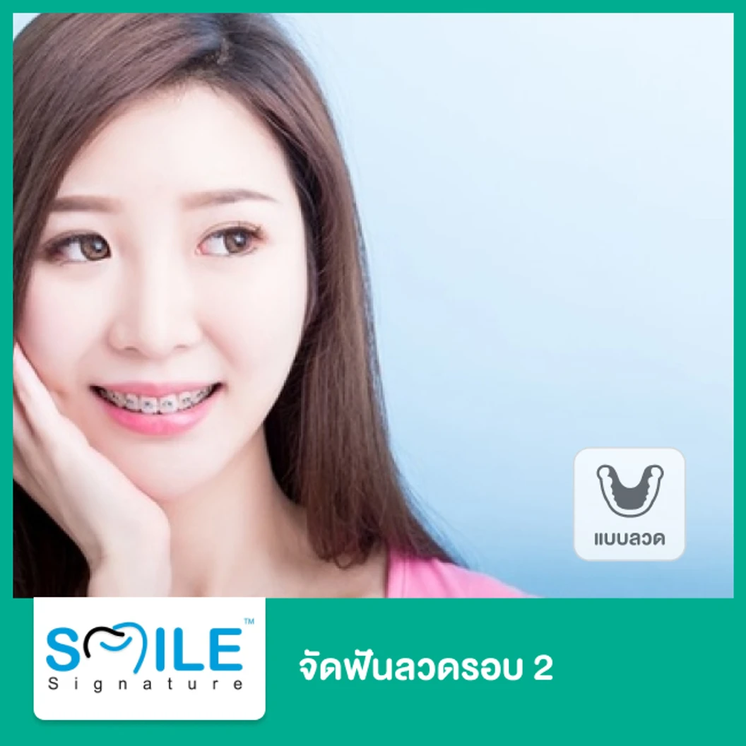 จัดฟันแบบโลหะรอบ 2 ที่ Smile Signature คลินิกทันตกรรมสไมล์ ซิกเนเจอร์