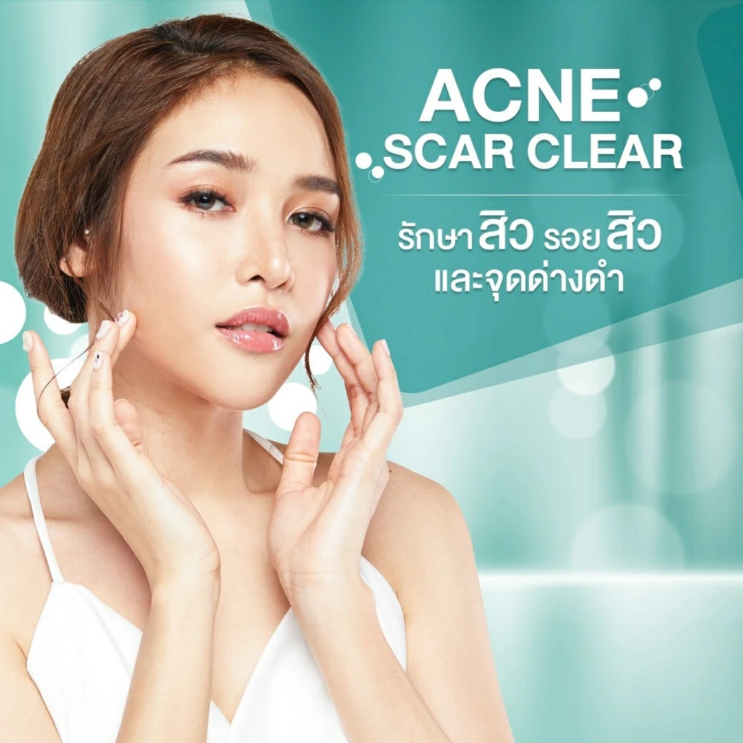 รักษาสิวและรอยสิว 7 ขั้นตอน 1 ครั้ง ที่ Atom Clinic