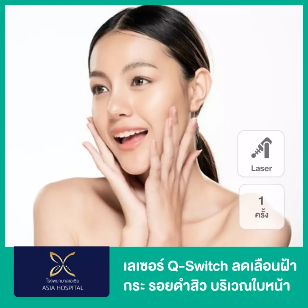 เลเซอร์ Q-Switch ลดเลือนฝ้า​ กระ​ รอยดำสิว บริเวณใบหน้า 1 ครั้ง ที่ โรงพยาบาลเอเซีย