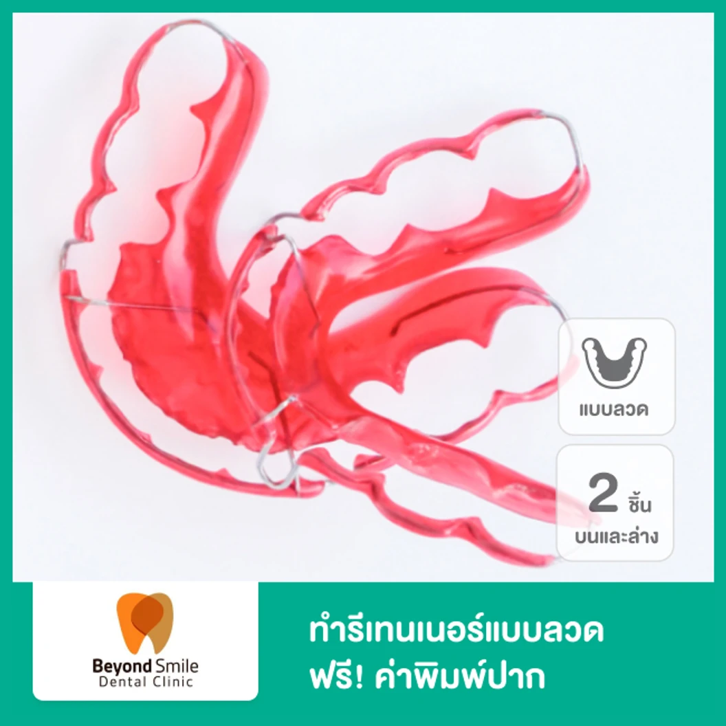 ทำรีเทนเนอร์แบบลวด 2 ชิ้น ฟันบนและล่าง ฟรี! ค่าพิมพ์ปาก ที่ Beyond Smile Dental Clinic