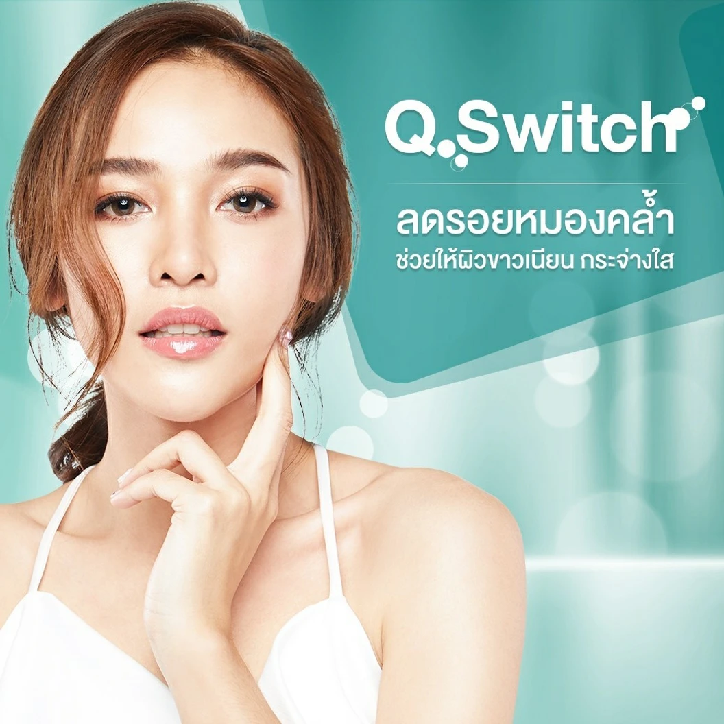 เลเซอร์ Q-Switch ลด ฝ้า กระ จุดด่างดำ บริเวณใบหน้า 1 ครั้ง ที่ Atom Clinic