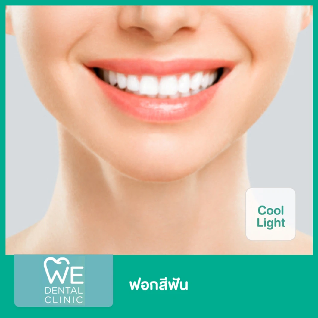 ฟอกสีฟัน ด้วยระบบ Cool Light ที่ WE Dental Clinic
