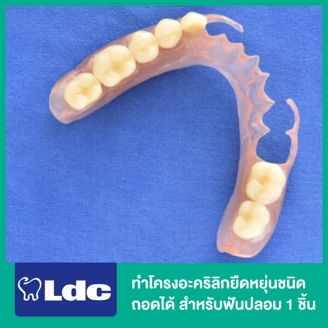 ทำโครงอะคริลิกยืดหยุ่นชนิดถอดได้ สำหรับฟันปลอม 1 ชิ้น ที่ LDC Dental