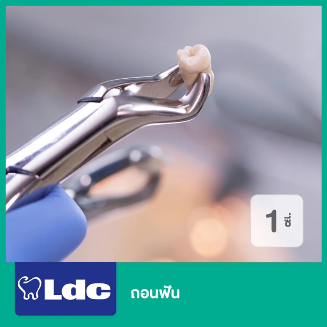 ถอนฟัน 1 ซี่ ที่ LDC Dental