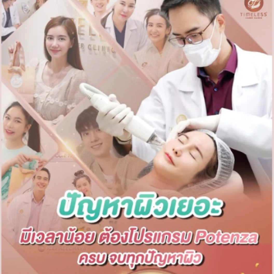 ยกกระชับใบหน้า แก้ปัญหาหลุมสิว ด้วยเครื่อง Potenza 1000 ช็อต 1 ครั้ง ฟรี! Vitamin Booster 1 ครั้ง ที่ Timeless Laser Clinic
