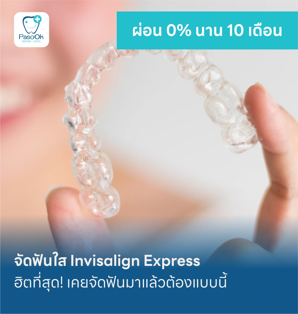 จัดฟันใส Invisalign Express แพ็กเกจ HDcare Lite ที่ คลินิกทันตกรรมพาสุข Pasook Dental Clinic