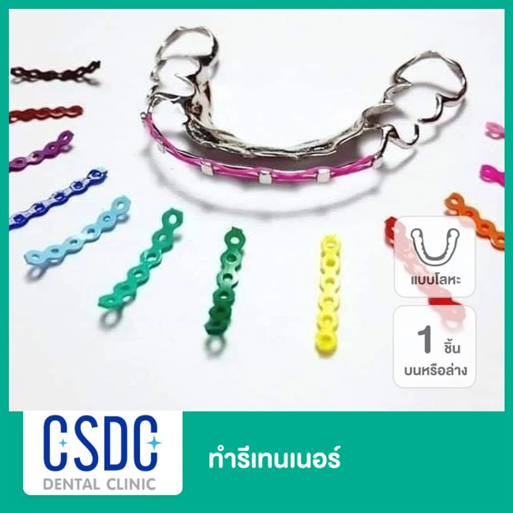 ทำรีเทนเนอร์แบบโลหะ 1 ชิ้น ฟันบนหรือล่าง ที่ CSDC