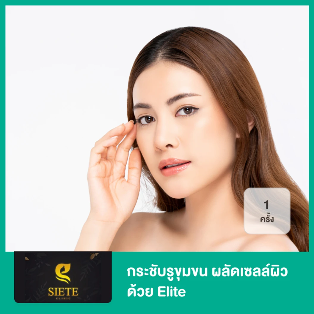 กระชับรูขุมขน ผลัดเซลล์ผิว ด้วย Elite 1 ครั้ง ที่ Siete Clinic