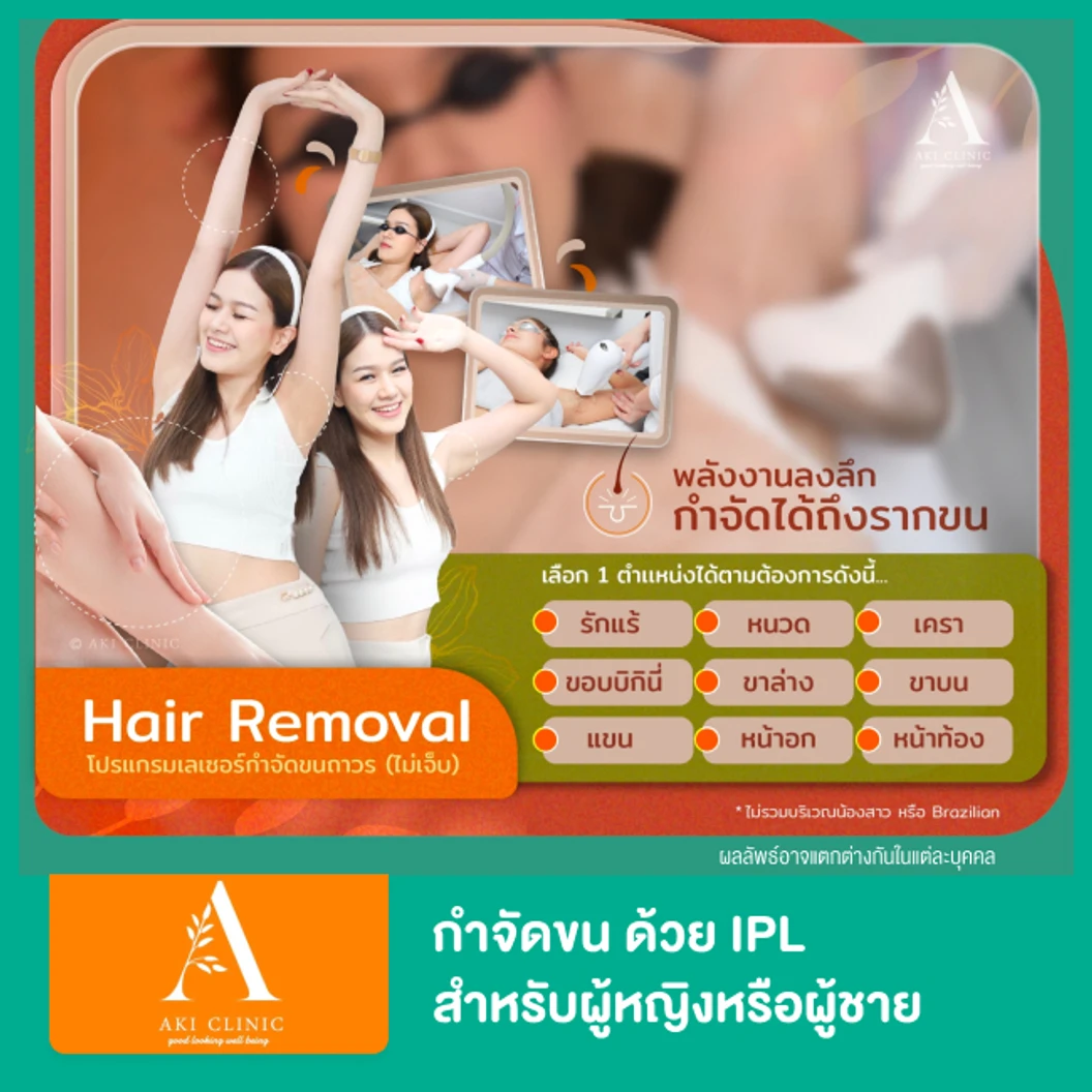 โปรแกรม IPL กำจัดขน 1 ครั้ง เลือก 1 จุด ที่ Aki Clinic
