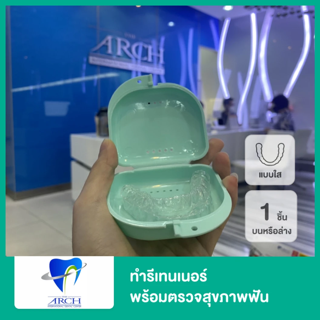 ทำรีเทนเนอร์แบบใส 1 ชิ้น บนหรือล่าง พร้อมตรวจสุขภาพฟัน ที่ The ARCH Dental Center ศูนย์ทันตกรรมดิอาร์ช