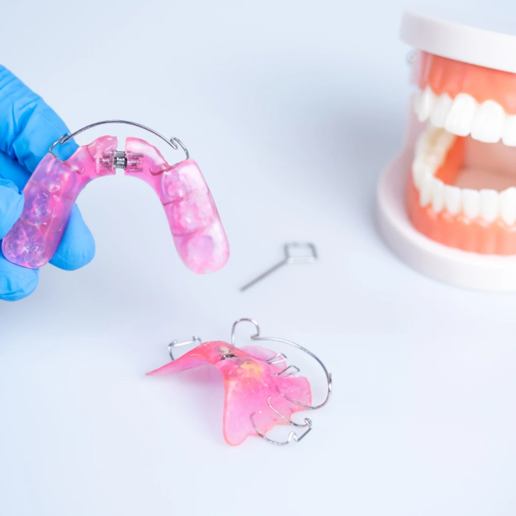 ทำรีเทนเนอร์แบบลวด 2 ชิ้น บนและล่าง พร้อมตรวจสุขภาพฟัน ที่ The ARCH Dental Center ศูนย์ทันตกรรมดิอาร์ช