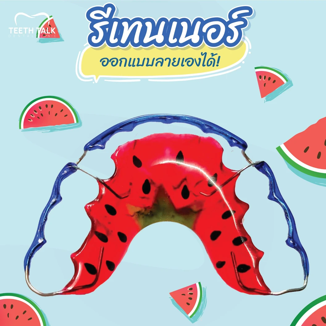 ทำรีเทนเนอร์แบบลวด 2 ชิ้น ฟันบนและล่าง ที่ Teeth Talk Dental Clinic