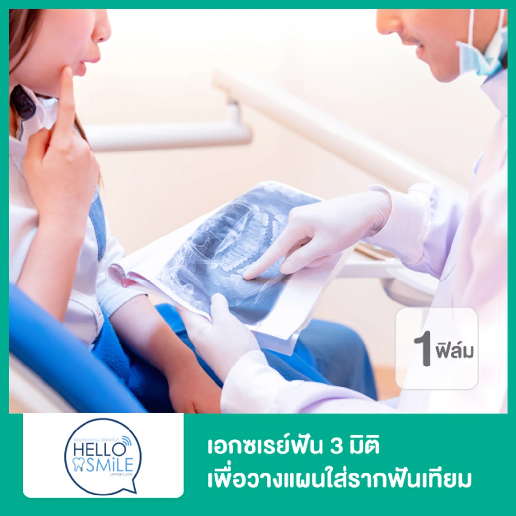 เอกซเรย์ฟัน 3 มิติ เพื่อวางแผนใส่รากฟันเทียม 1 ฟิล์ม ที่ Hello Smile Dental Clinic